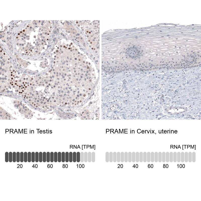 Analysis in human testis and cervix, uterine tissues using NBP3-44111 antibody. Corresponding PRAME RNA-seq data are presented for the same tissues.