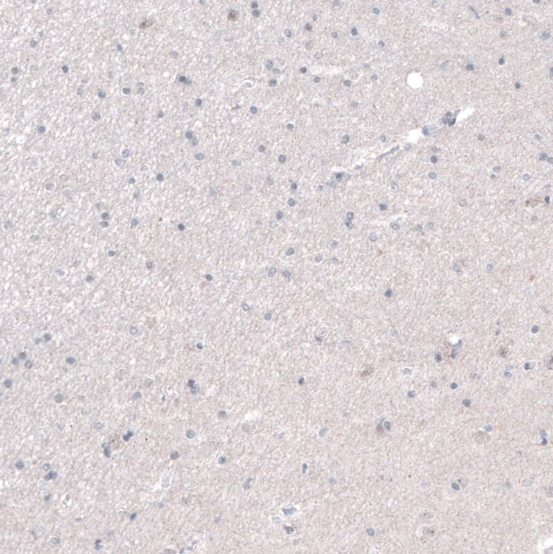 Staining of human cerebral cortex shows no positivity in neurons as expected.