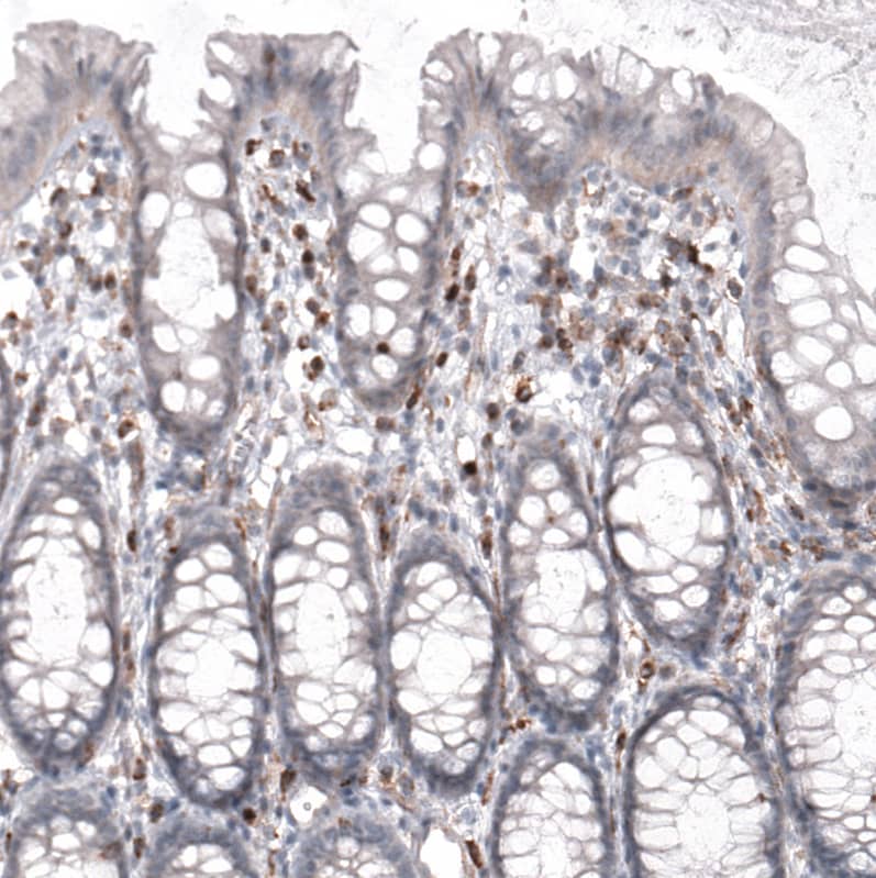 Staining of human rectum shows moderate to strong cytoplasmic positivity in lymphoid cells.