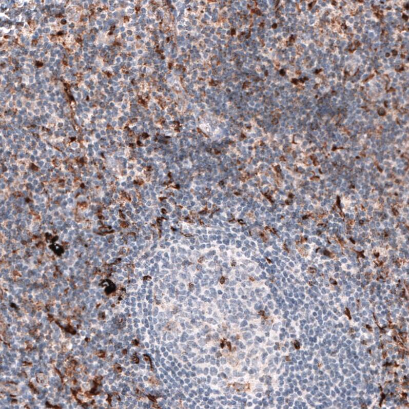 Staining of human lymph node shows moderate to strong cytoplasmic positivity in non-germinal center cells.