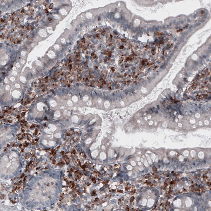 Staining of human small intestine shows strong immunoreactivity in lymphoid cells.