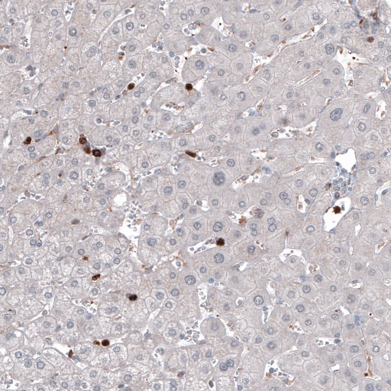 Staining of human liver shows strong positivity in a subset of lymphoid cells.