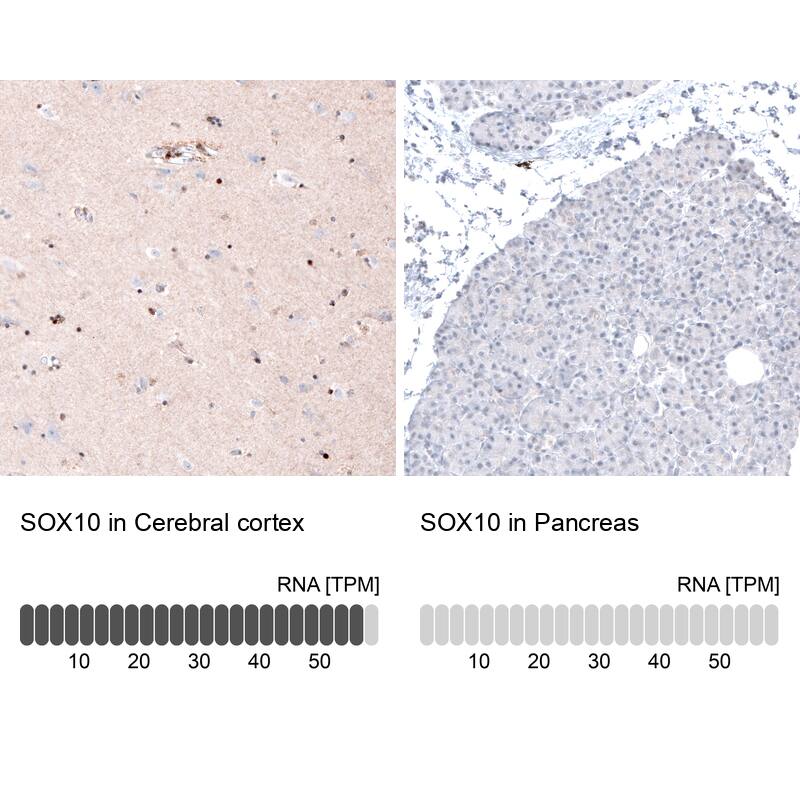 Analysis in human cerebral cortex and pancreas tissues using NBP3-44116 antibody. Corresponding SOX10 RNA-seq data are presented for the same tissues.
