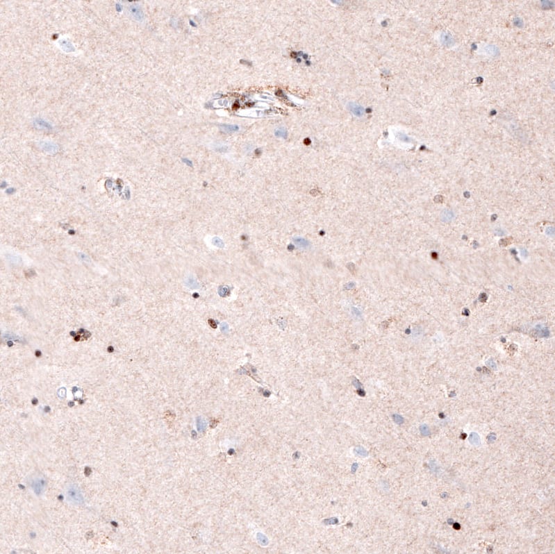 Staining of human cerebral cortex shows  strong nuclear positivity in glial cells (oligodendrocytes).