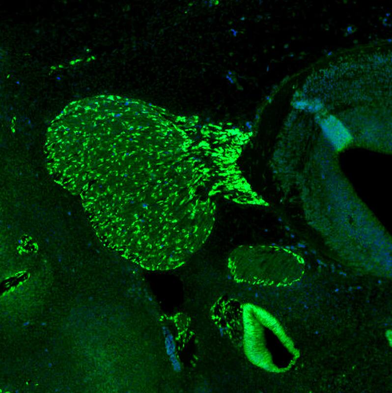 Staining of mouse embryo E11 shows strong positivity in the developing trigeminal ganglion.