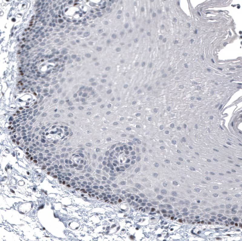 Staining of human squamous epithelium shows strong nuclear positivity in stratum basale cells.