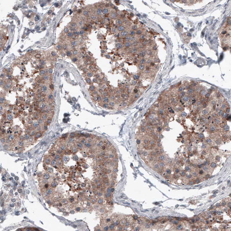 Staining of human testis shows cytoplasmic positivity in seminiferous tubules.