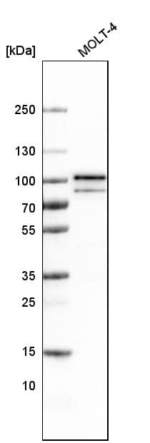 Analysis in human cell line MOLT-4.