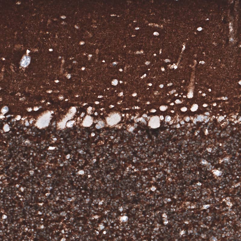 Staining of human cerebellum shows strong positivity in neuropil.