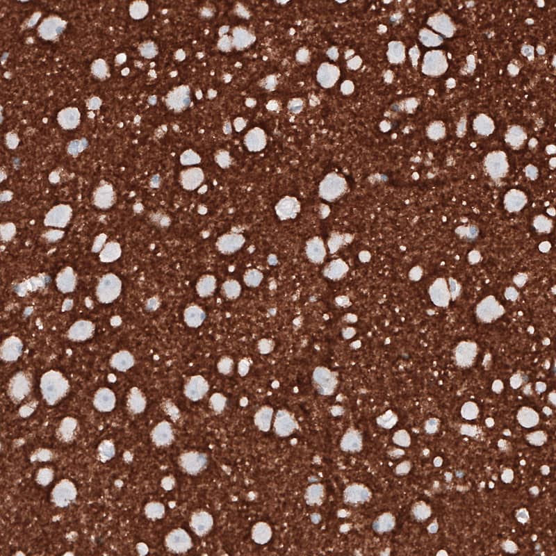 Staining of human cerebral cortex shows strong immunoreactivity in neuropil.