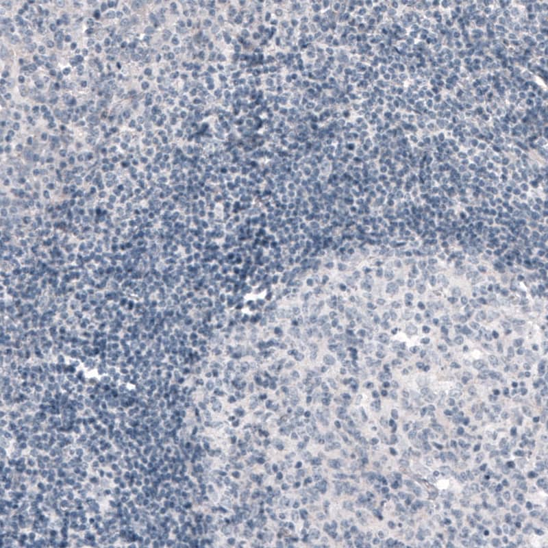 Staining of human tonsil shows no positivity as expected (negative control).