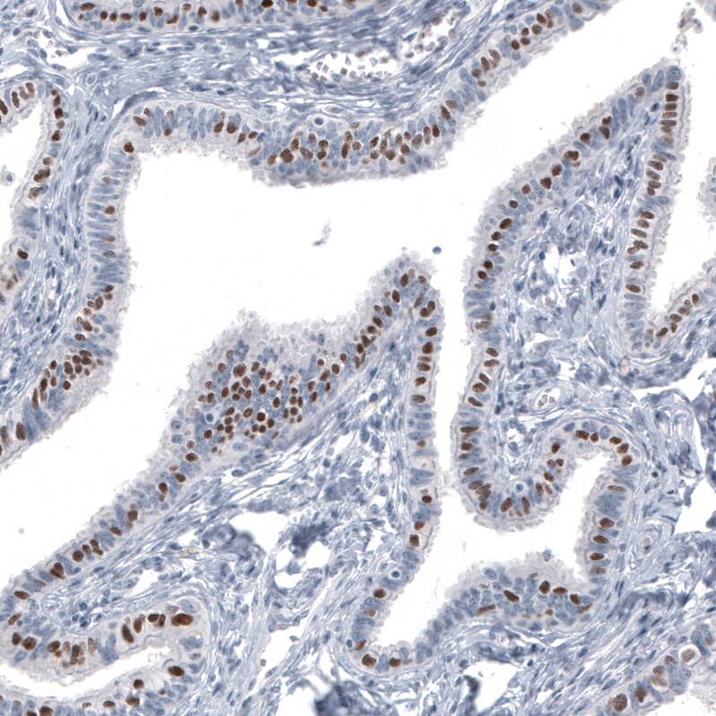 Staining of human fallopian tube shows moderate to strong nuclear positivity in glandular cells.