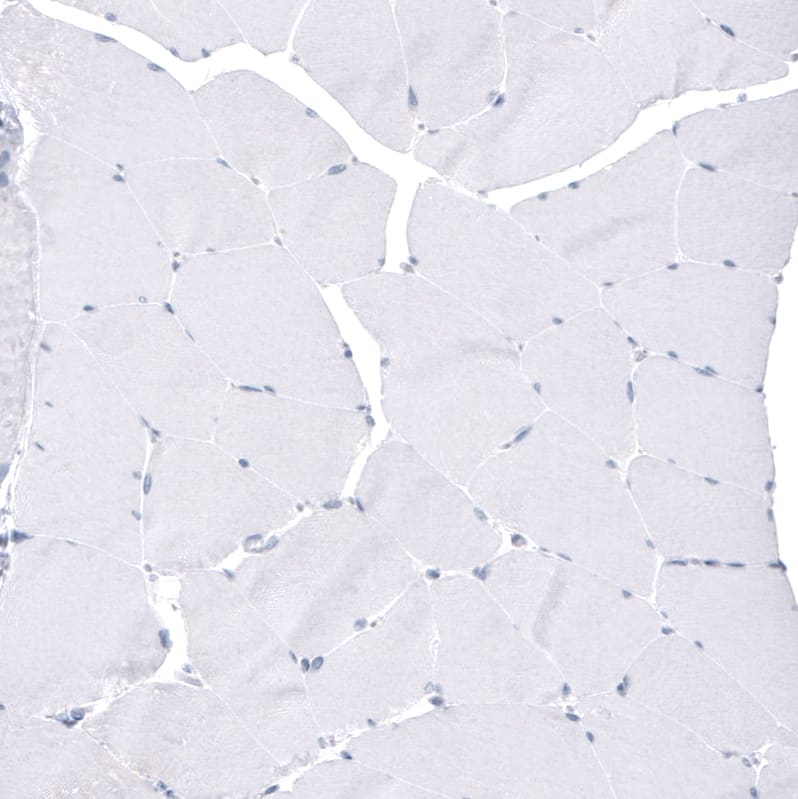 Staining of human skeletal muscle shows no positivity in myocytes as expected.