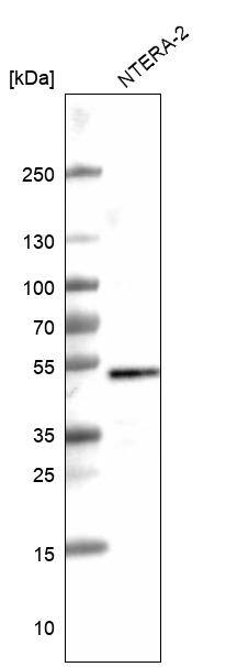 Analysis in human cell line NTERA-2.