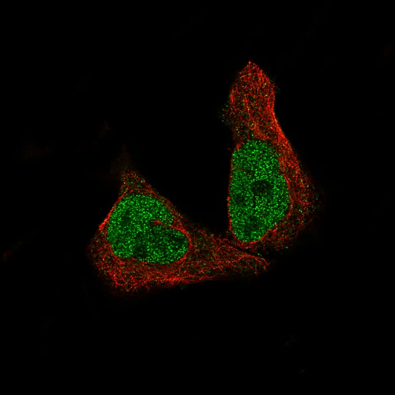 Staining of RH-30 cells, showing specific staining in the nucleoplasm in green. Microtubule- and nuclear probes are visualized in red and blue, respectively (where available).