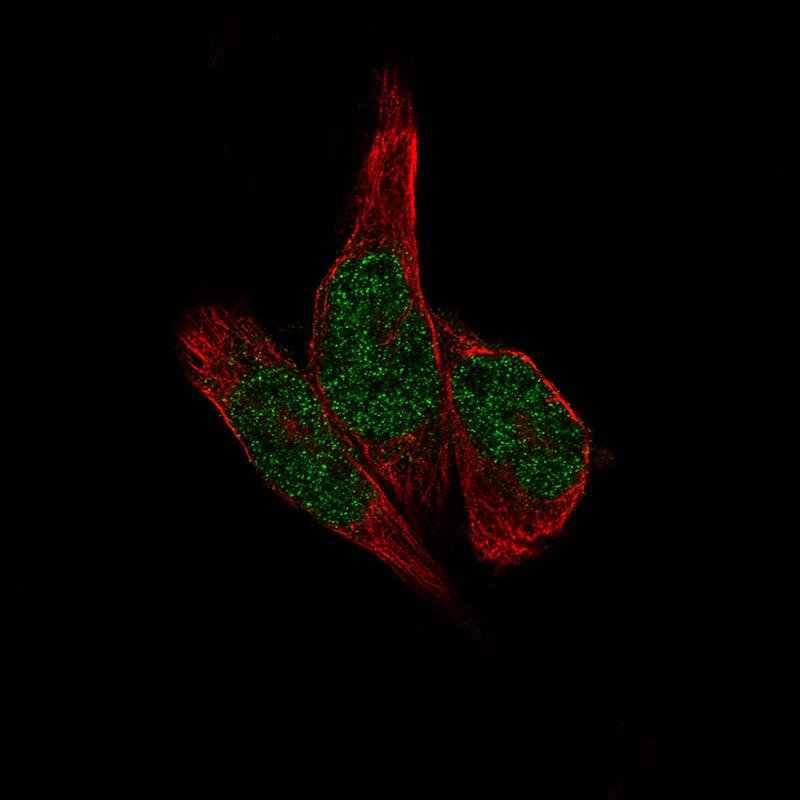 Staining of RH-30 cells using the Anti-METTL14 monoclonal antibody) .