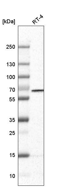 Analysis in human cell line RT-4.