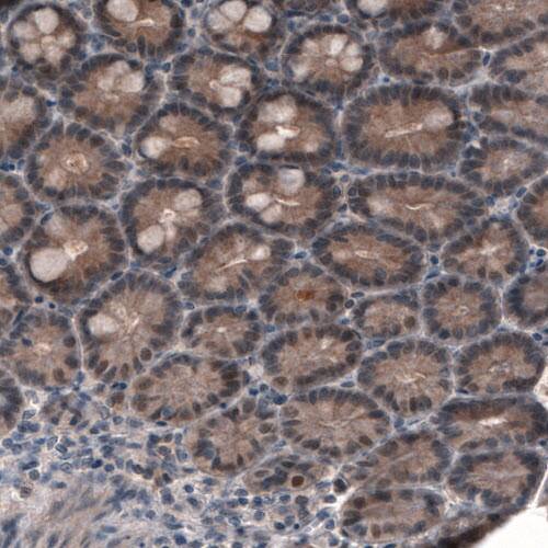 Staining of human small intestine shows cytoplasmic positivity in glandular cells.