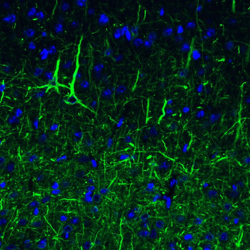 Staining of mouse cerebral cortex shows strong immunoreactivity in neuronal cell bodies and processes.
