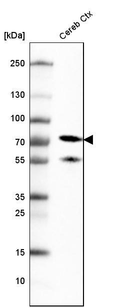 Analysis in human cerebral cortex tissue.