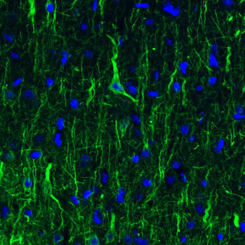 Staining of rat cerebral cortex shows strong immunoreactivity in neuronal cell bodies and processes.