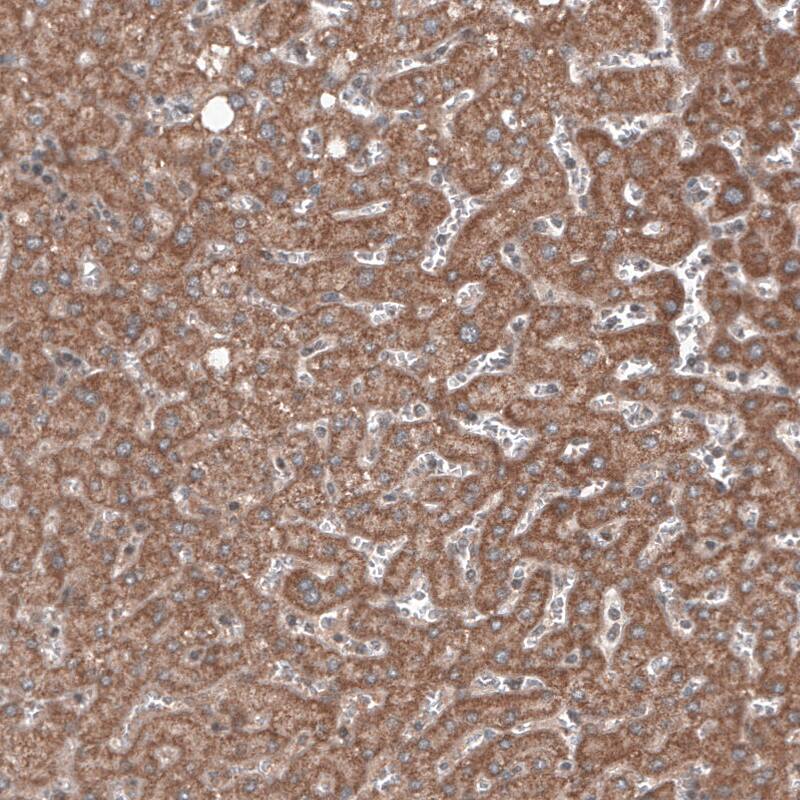 Staining of human liver shows cytoplasmic immunoreactivity in hepatocytes.