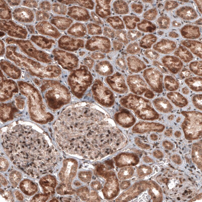 Staining of human kidney shows moderate to strong cytoplasmic positivity mainly in renal tubules.