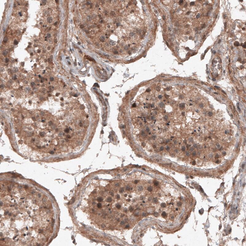 Staining of human testis shows cytoplasmic positivity in seminiferous tubules.