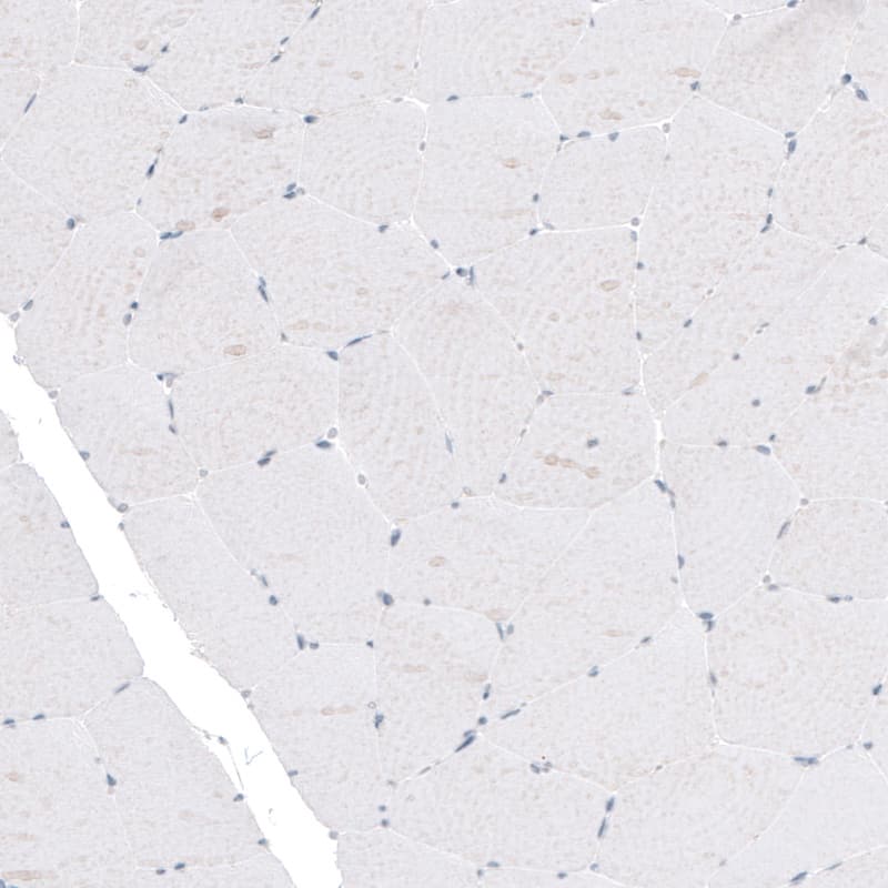 Staining of human skeletal muscle shows no positivity in muscle fibers as expected (negative control).