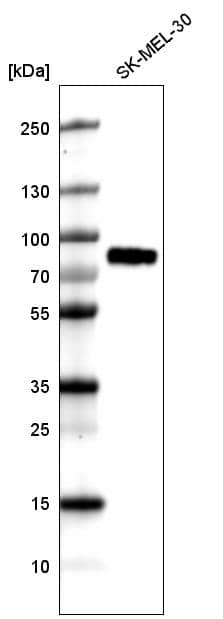 Analysis in human cell line SK-MEL-30.