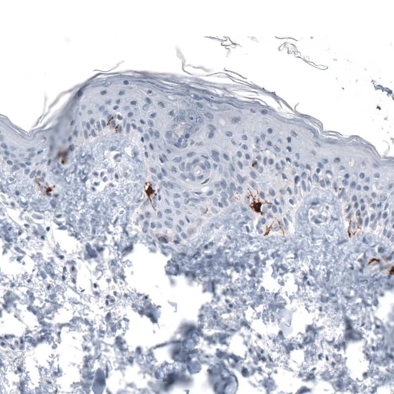 Staining of human skin shows strong cytoplasmic immunoreactivity in melanocytes.