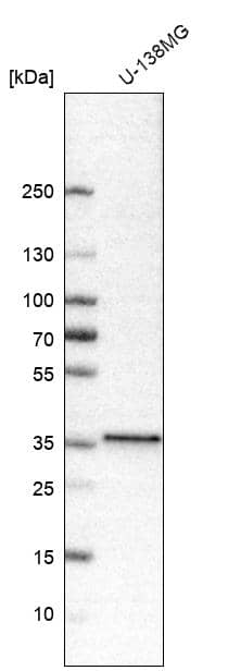 Analysis in human cell line U-138MG.