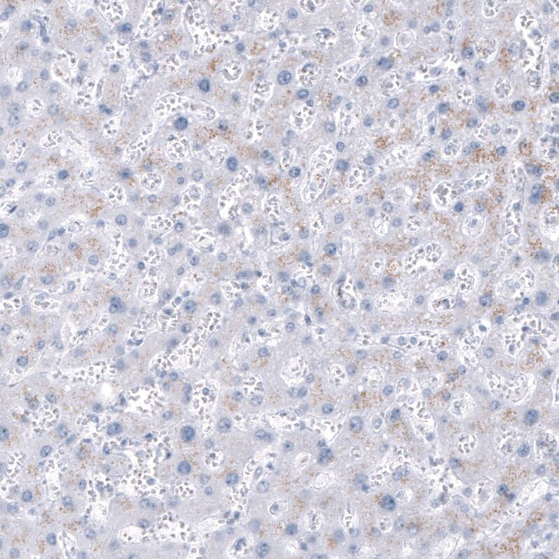 Staining of human Liver shows no positivity in hepatocytes as expected.