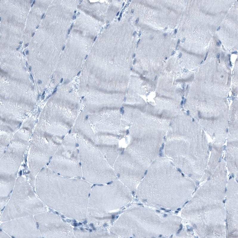 Staining of human skeletal muscle shows no positivity as expected.