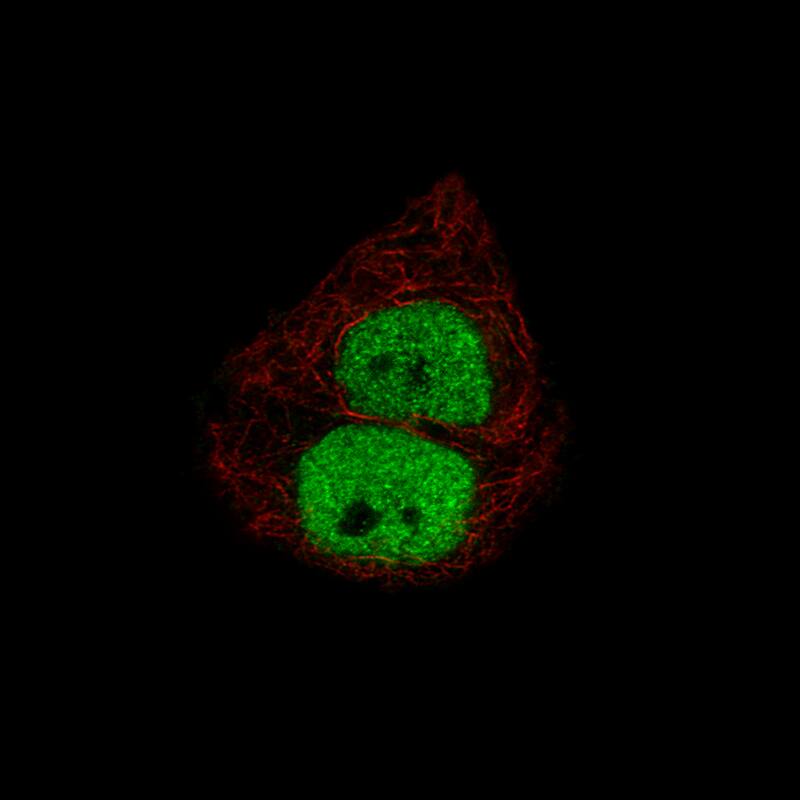 Staining of T47D cells, showing specific staining in the nucleoplasm in green. Microtubule- and nuclear probes are visualized in red and blue, respectively (where available).