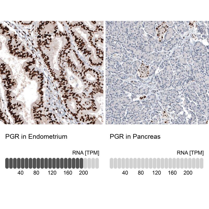 Analysis in human endometrium and pancreas tissues using NBP3-44136 antibody. Corresponding Progesterone R B/NR3C3 RNA-seq data are presented for the same tissues.