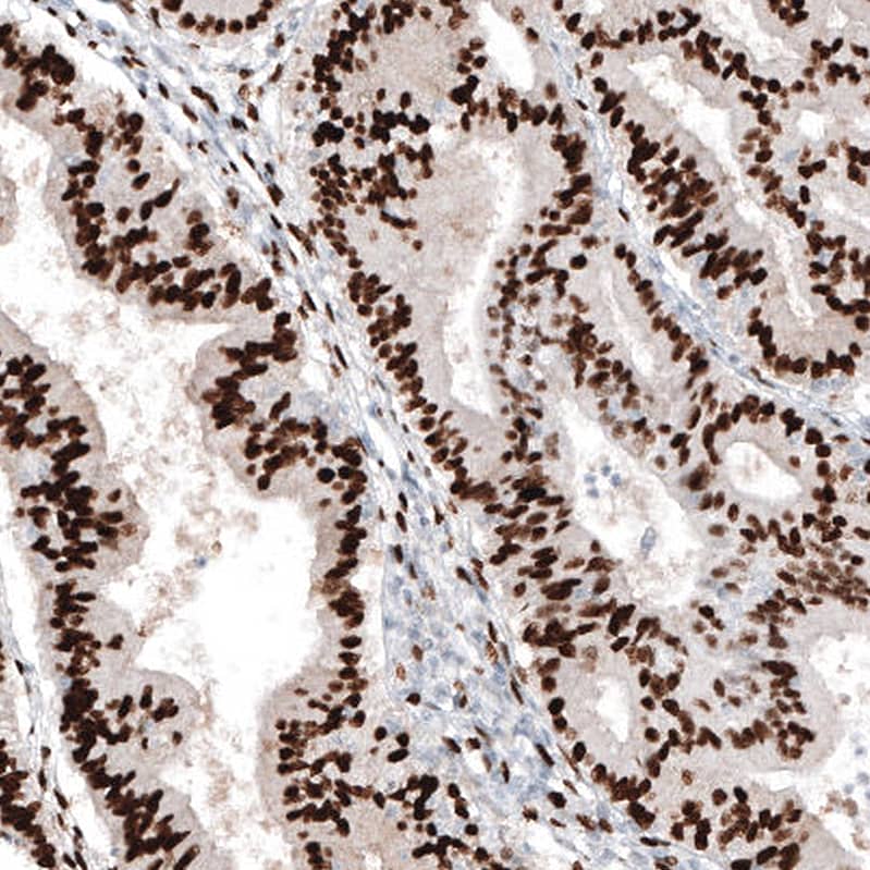 Staining of human endometrium shows strong nuclear positivity in glandular cells.
