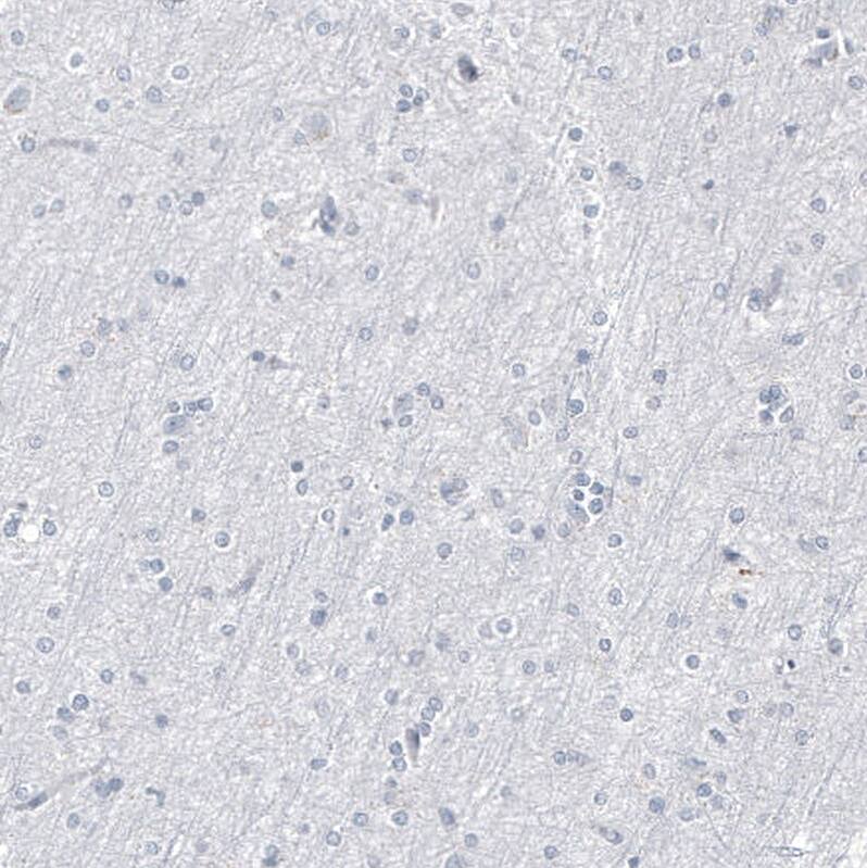 Staining of human cerebral cortex shows no positivity in neurons as expected.