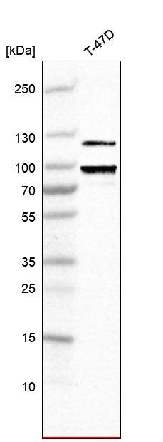 Analysis in human cell line TD47D.