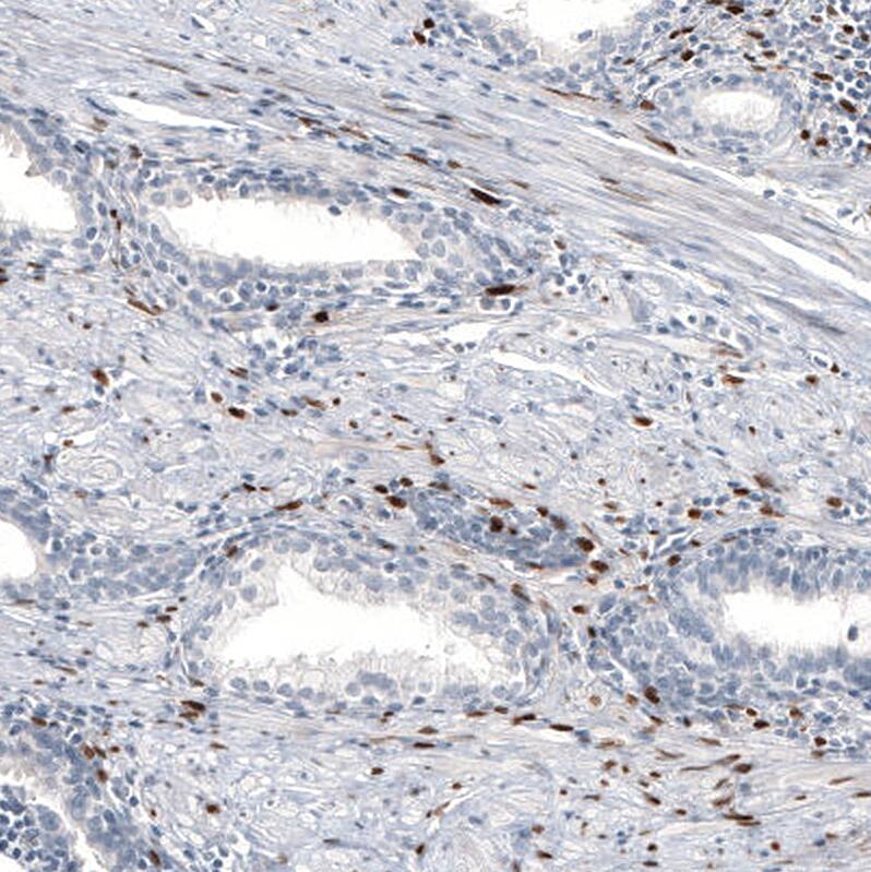 Staining of human prostate shows moderate to strong nuclear positivity in smooth muscle cells.