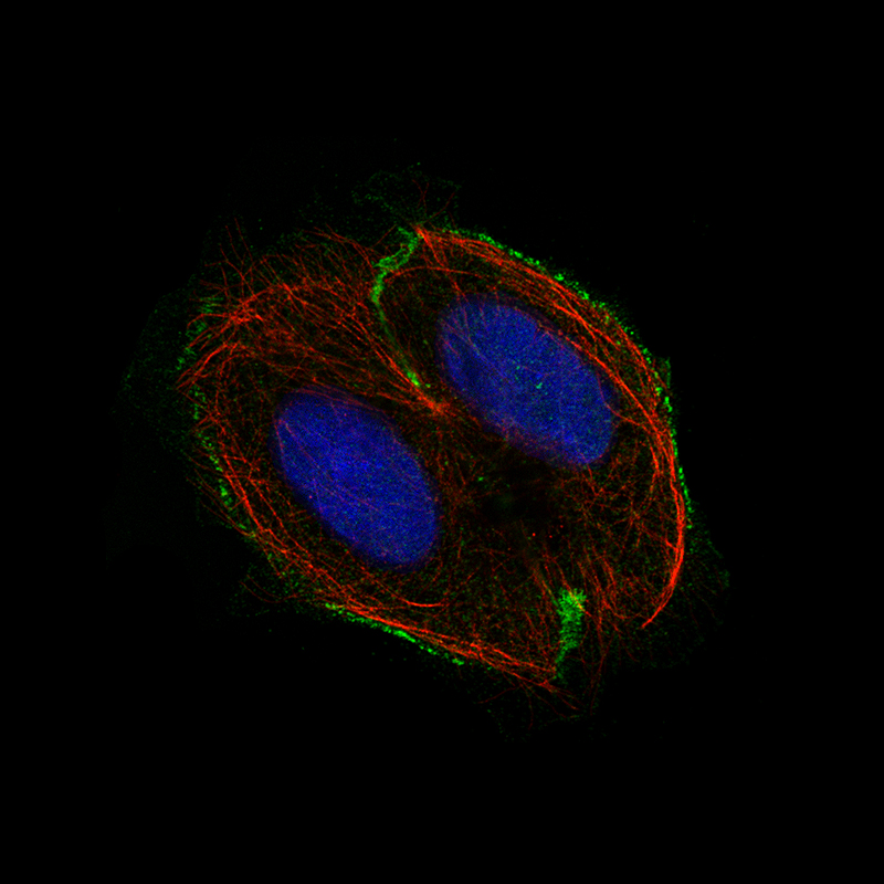 Staining of BeWo cells using the Anti-M-CSFR/CD115 monoclonal antibody) . 
