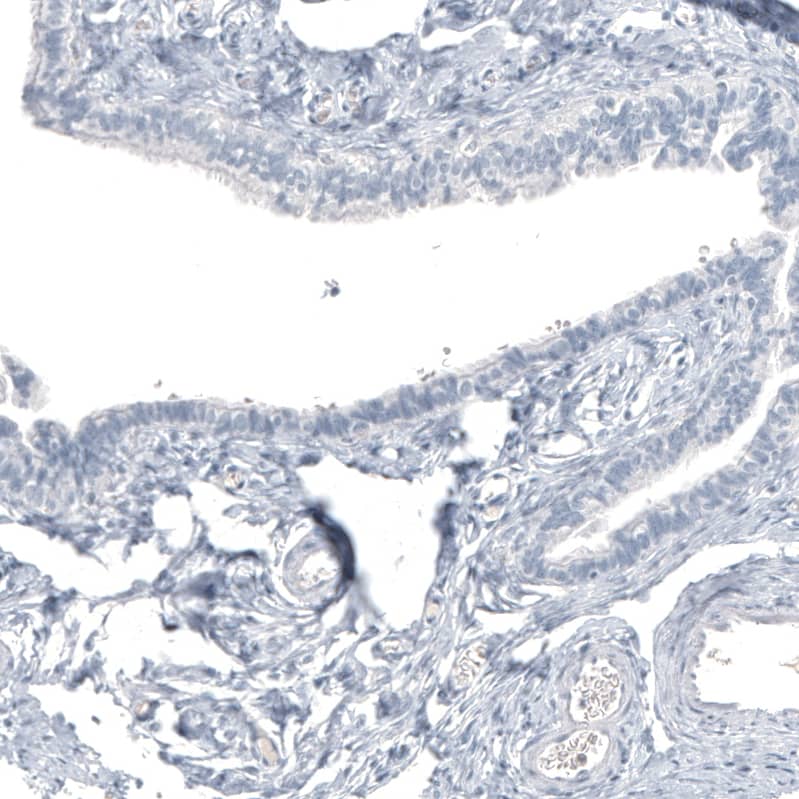 Staining of human fallopian tube shows no positivity in glandular cells as expected.