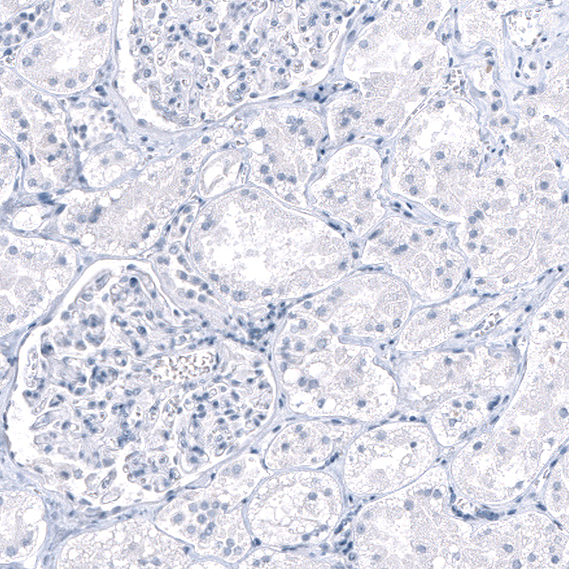 Staining of human Kidney shows no positivity in cells in seminiferous ducts as expected.