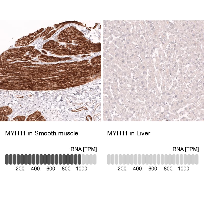 Analysis in human smooth muscle and liver tissues using NBP3-44140 antibody. Corresponding Myosin heavy chain 11 RNA-seq data are presented for the same tissues.
