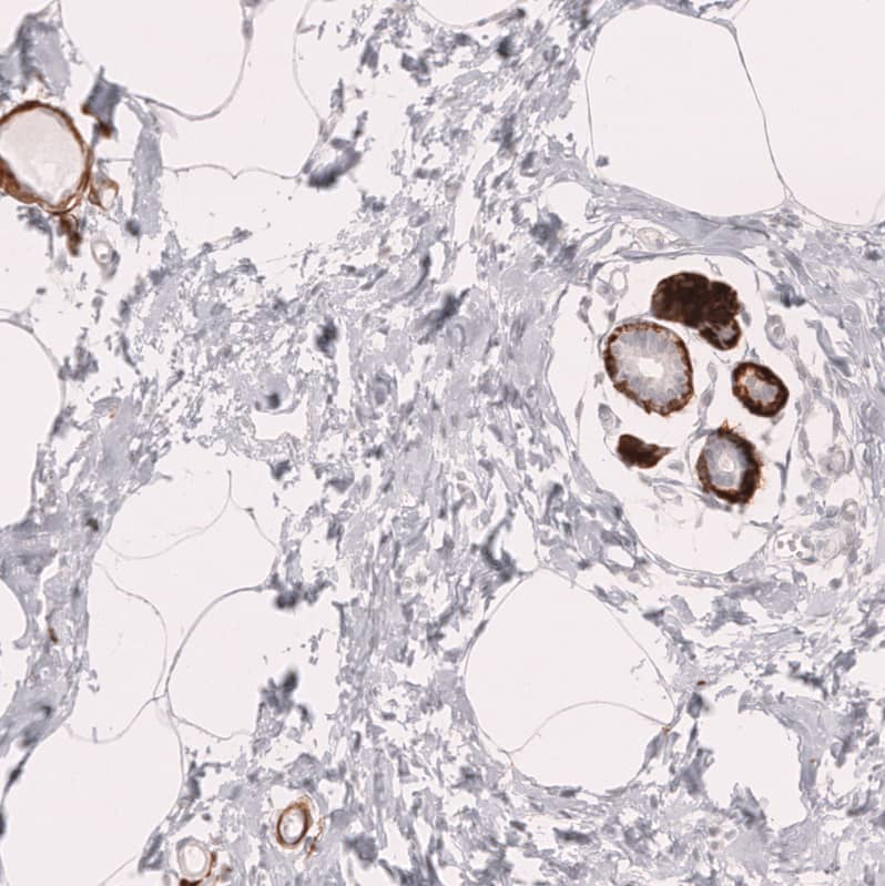 Staining of human breast shows strong cytoplasmic positivity in myoepithelial cells.