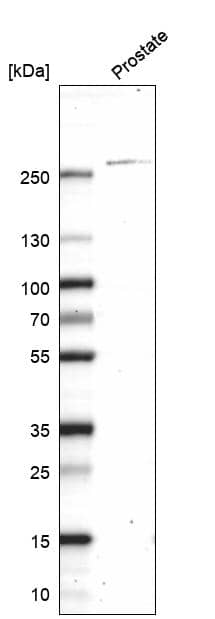 Analysis in human prostate tissue.