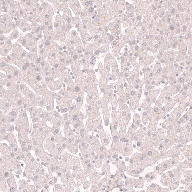 Staining of human liver shows no positivity in hepatocytes as expected.