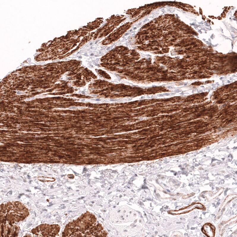 Staining of human smooth muscle shows strong cytoplasmic positivity in smooth muscle cells.
