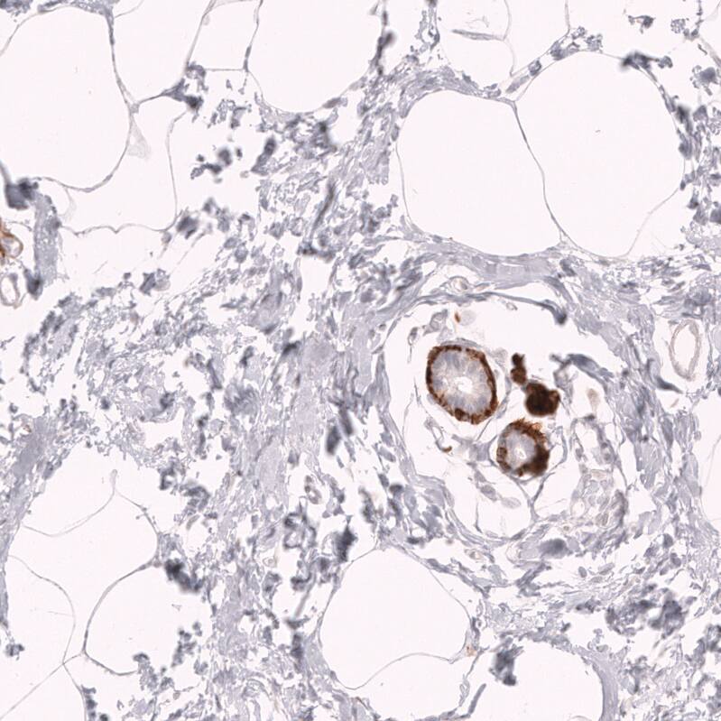 Staining of human breast shows strong cytoplasmic positivity in myoepithelial cells.