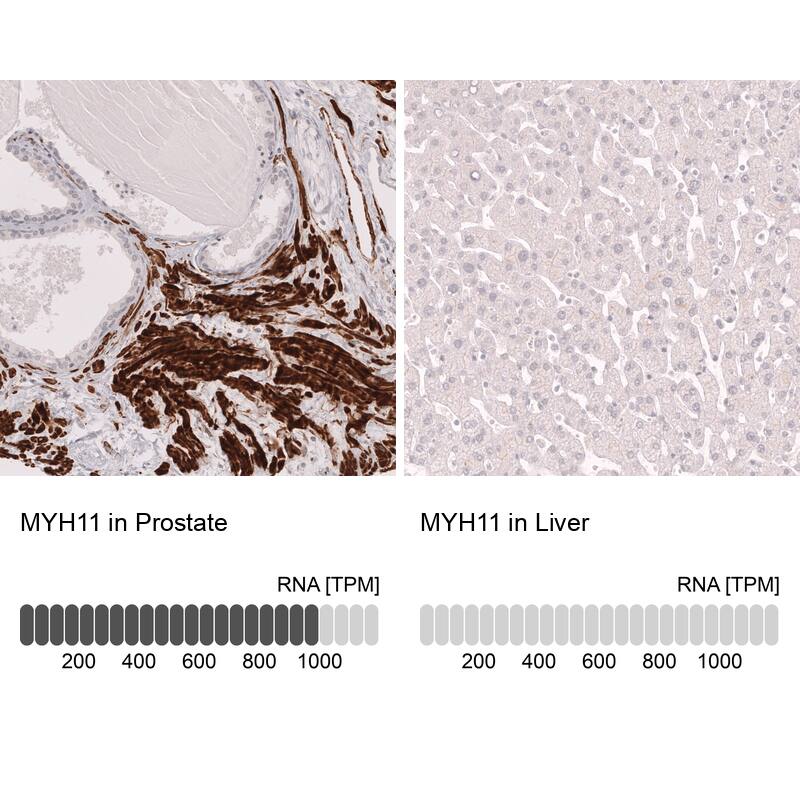 Analysis in human prostate and liver tissues using NBP3-44141 antibody. Corresponding Myosin heavy chain 11 RNA-seq data are presented for the same tissues.